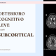 Deterioro cognitivo leve de perfil subcortical