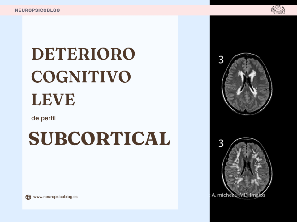 Deterioro cognitivo leve de perfil subcortical